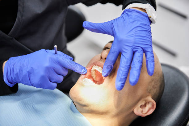Best Knocked-Out Tooth Emergency  in Universal City, TX